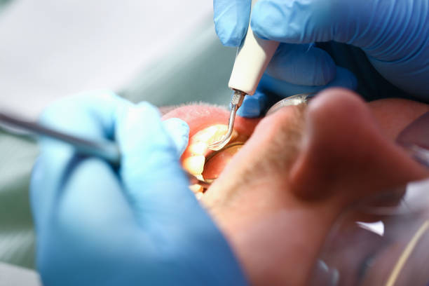 Emergency Cosmetic Dentistry